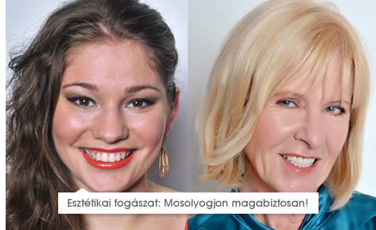 Esettanulmányok
